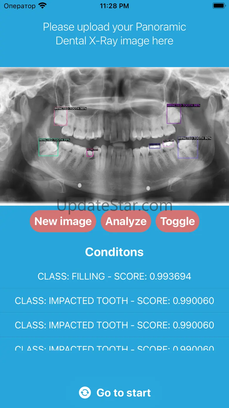 DentalScanner 2.2