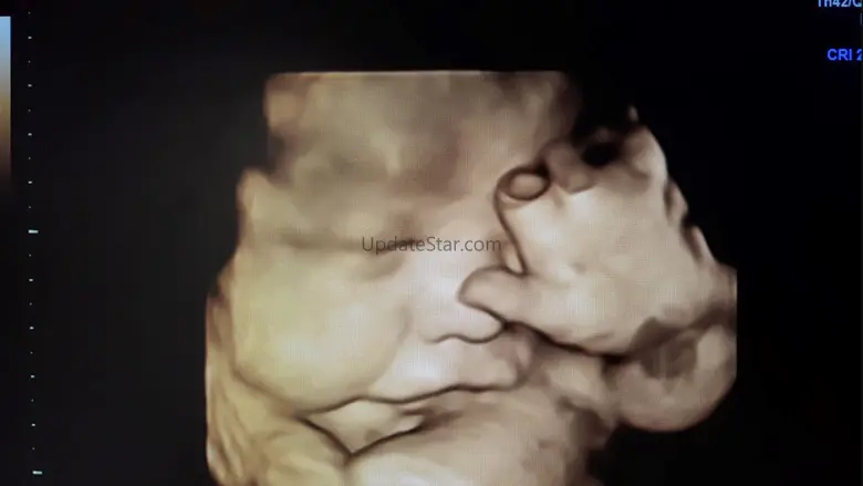 Sona: Baby 2.1.8