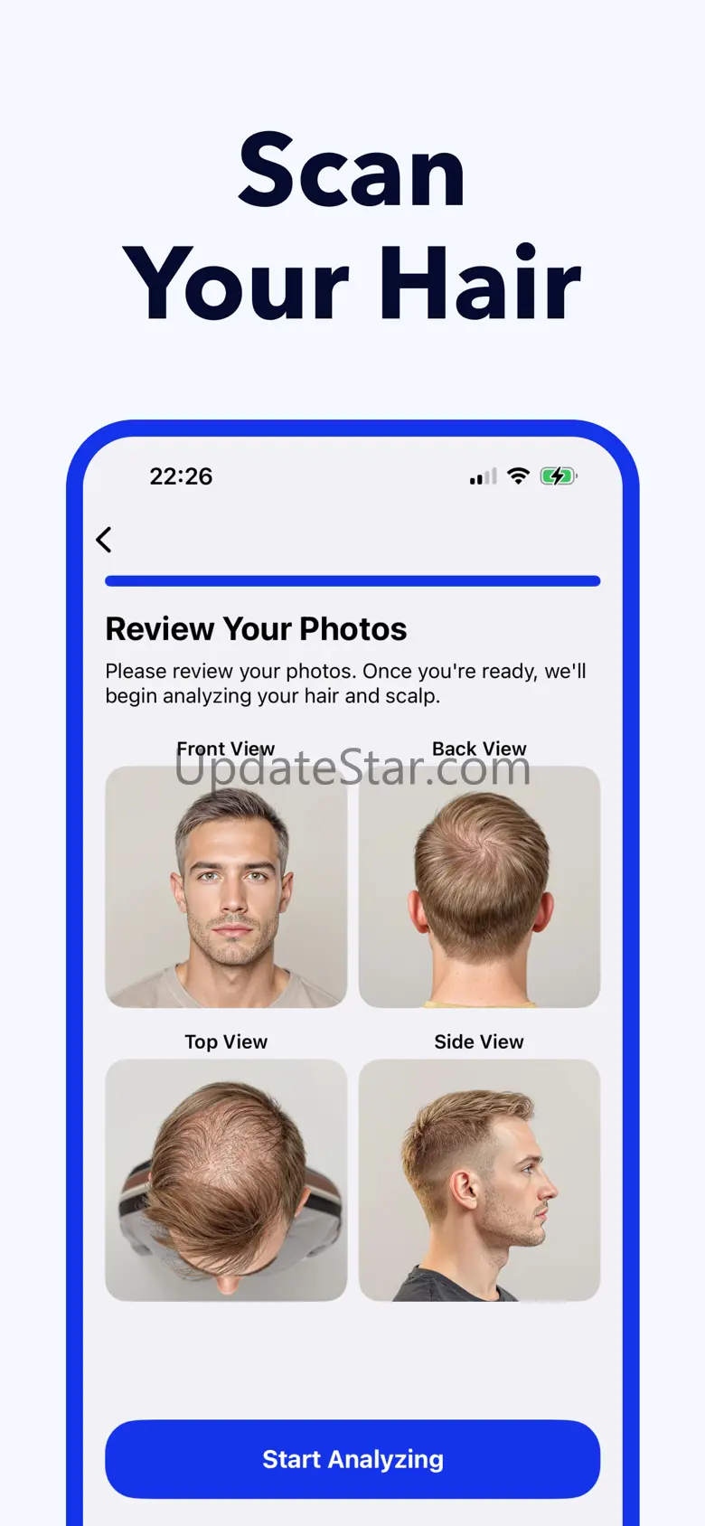 Hair Snap Hairloss Scan 1.1