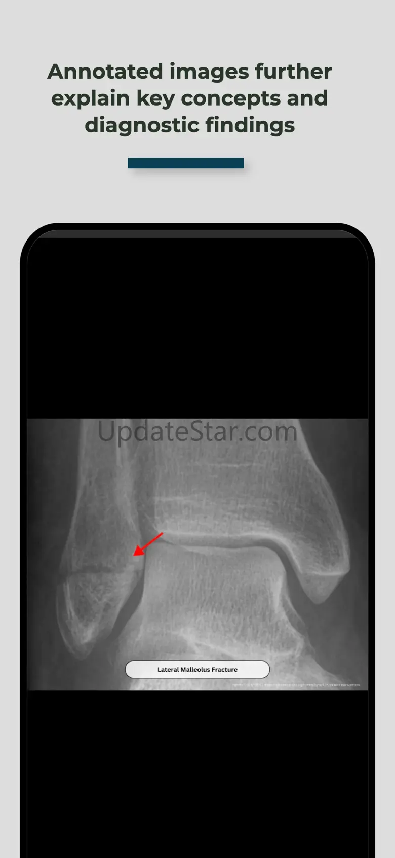 Blox Medical 1.0.4