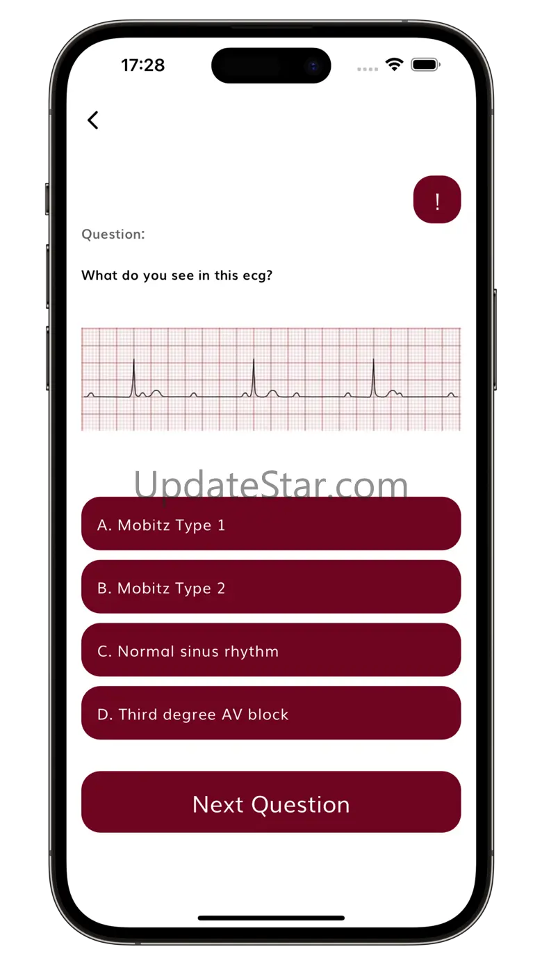 Cardiology Cases: EKG Practice 4.3