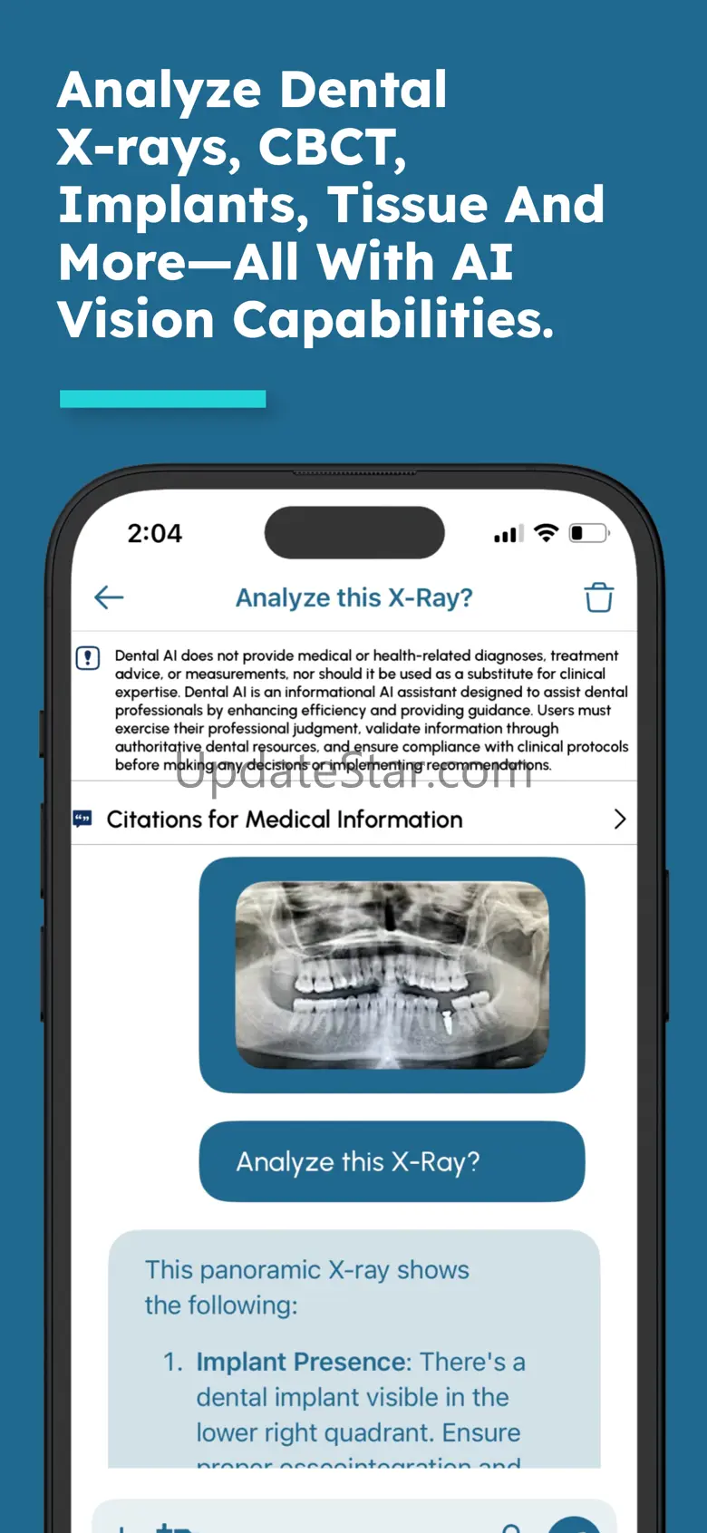 Dental AI:Assist for Dentistry 1.0