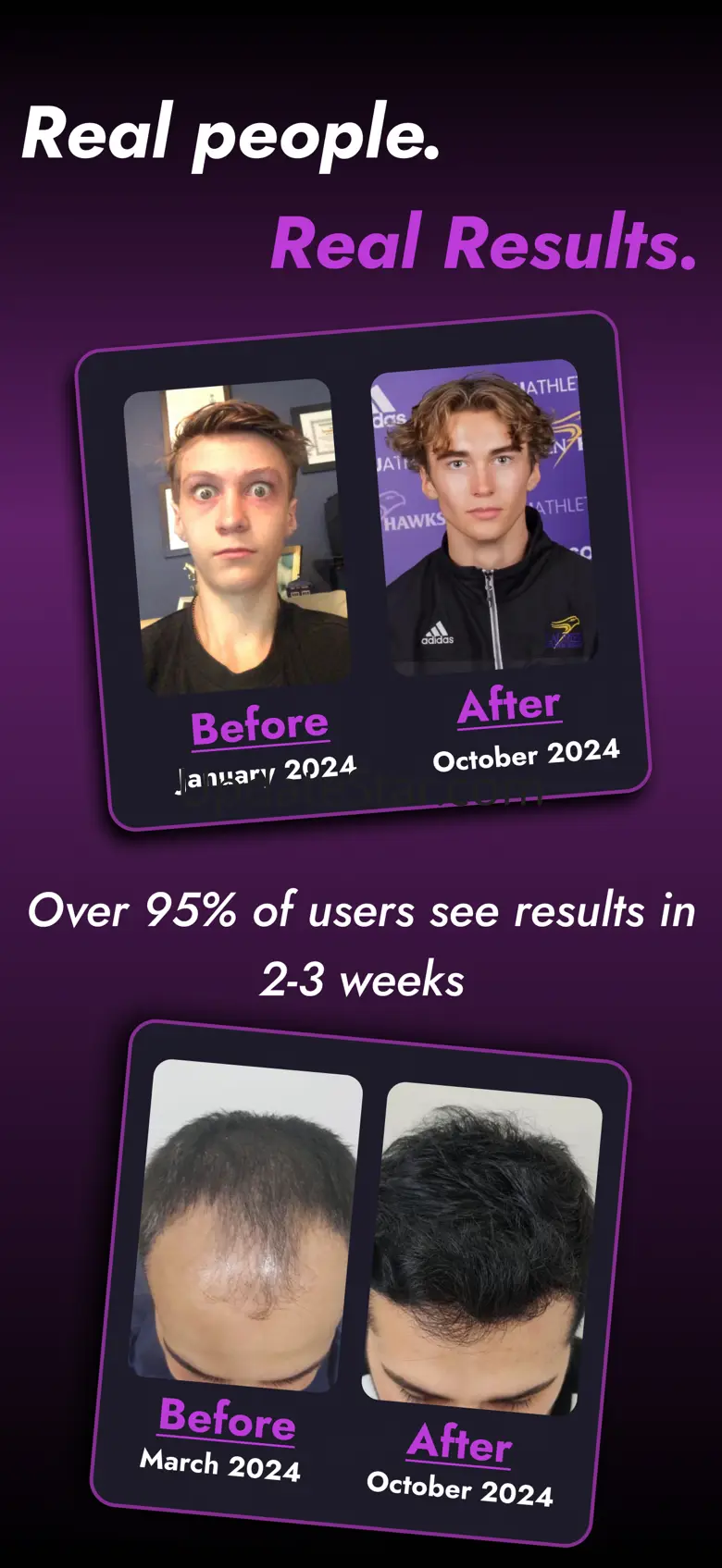 HairIQ AI Health & Style Scan 1.8