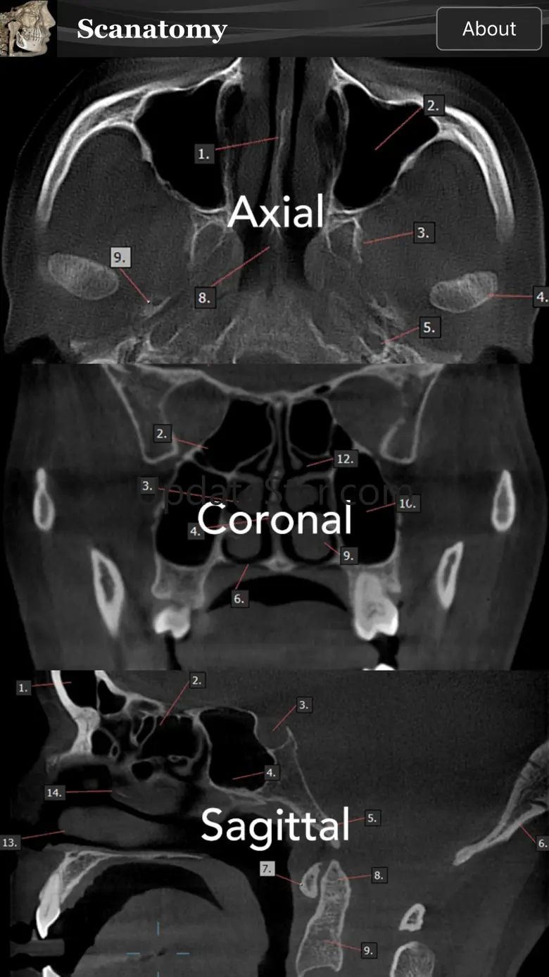 Scanatomy 1.1