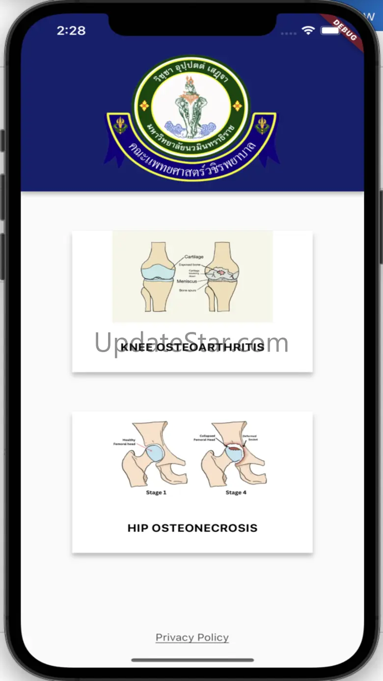 Vajira Smart Joint 1.1.0