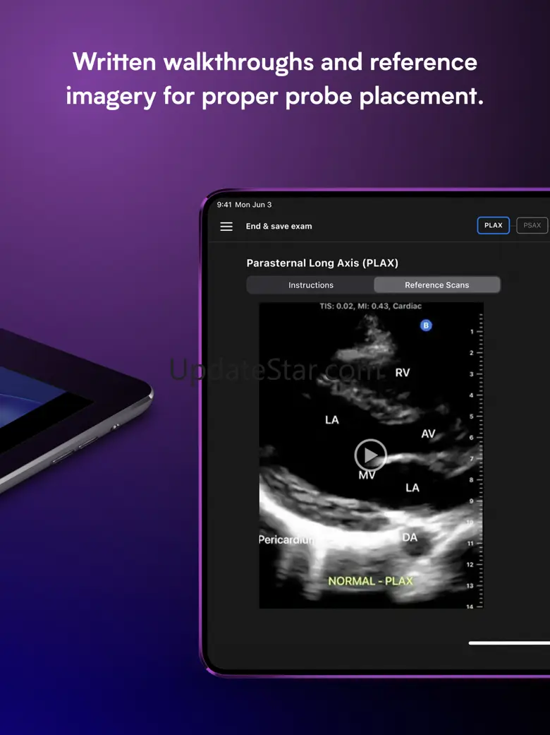 Butterfly ScanLab 1.4.0