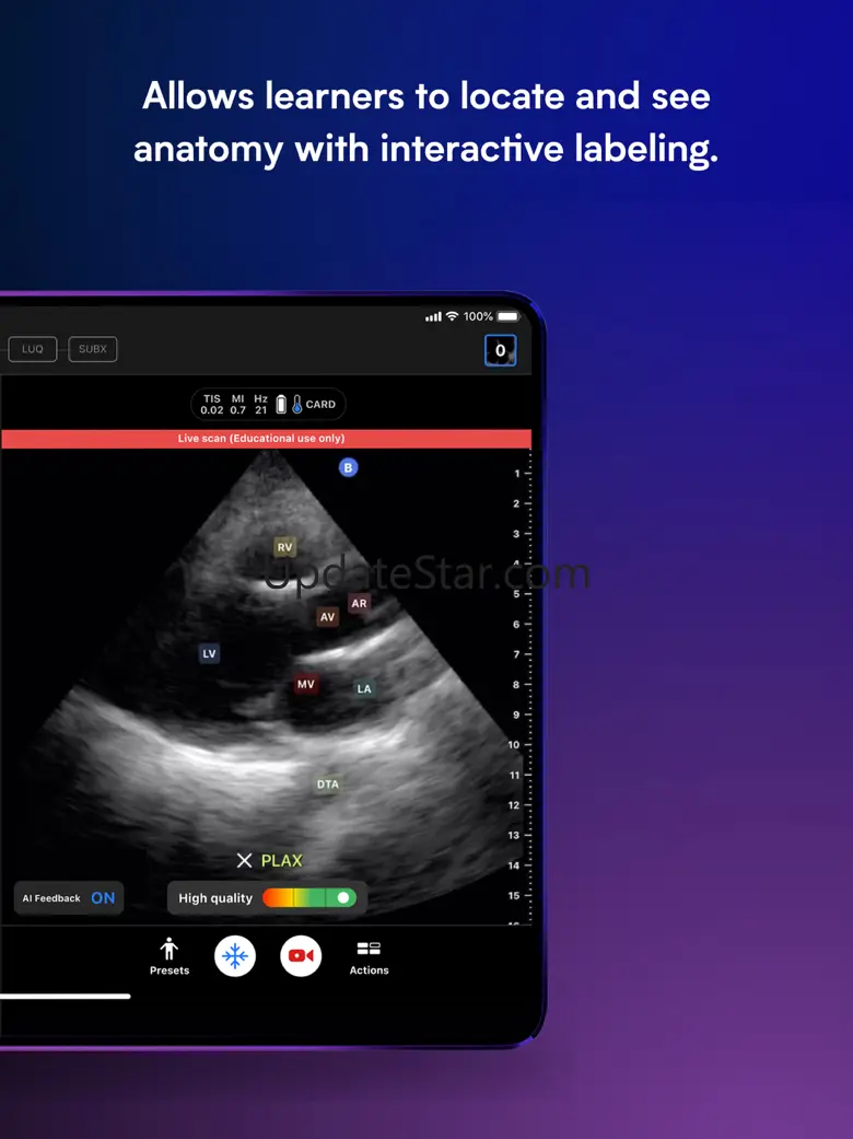 Butterfly ScanLab 1.4.0