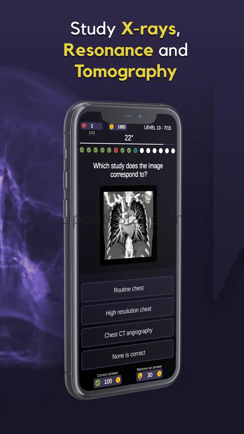 RX Trivia - Radiology Quiz 1.1.0