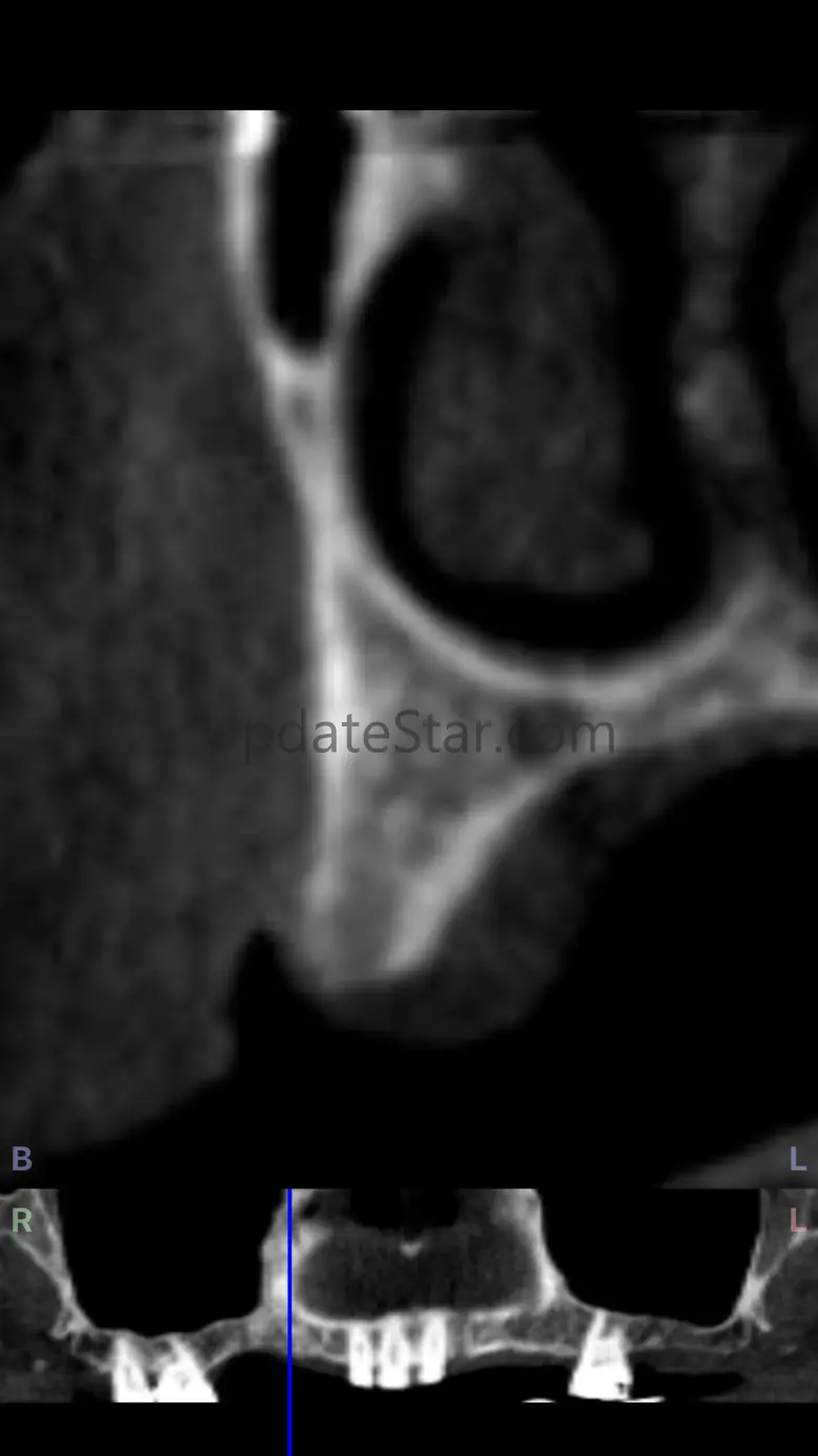 Dental CT View 2.7.8
