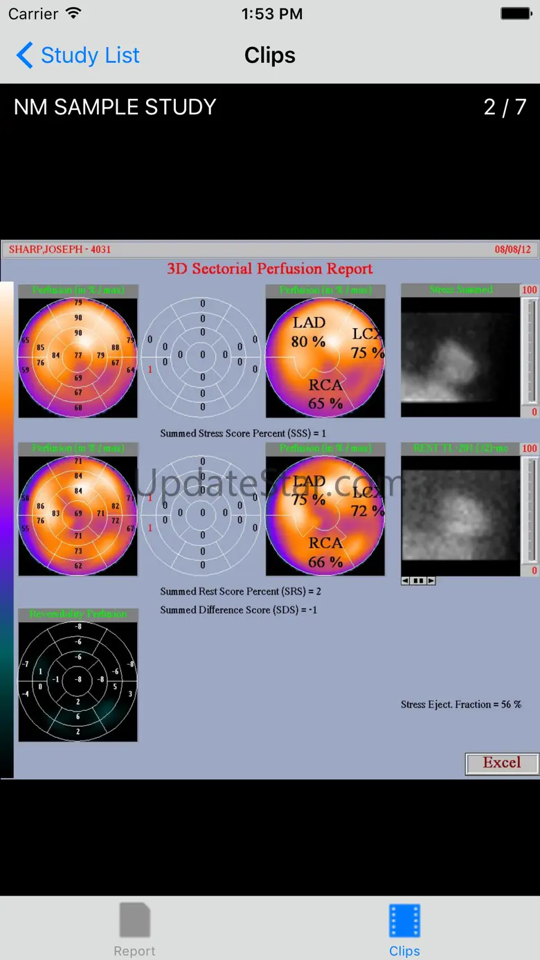 VidistarViewer 2.3.0