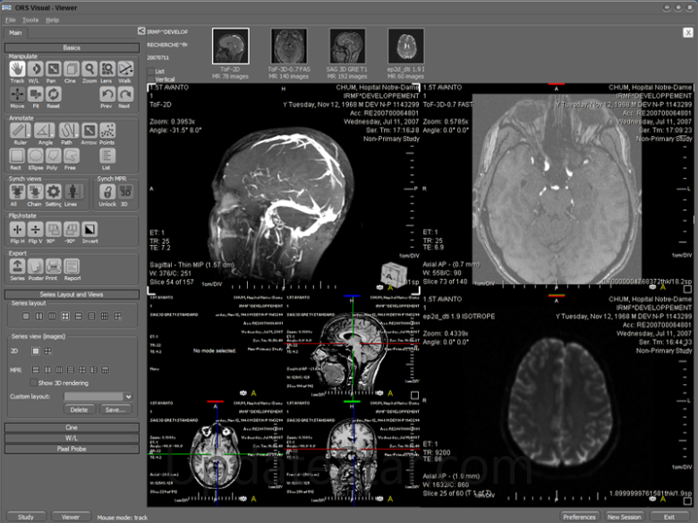 ORS Visual Lite 1.5.1
