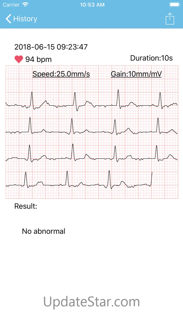 mini ECG 1.9.7