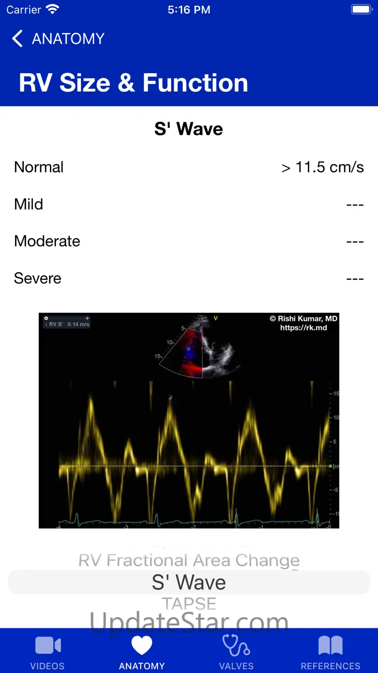 EchoTools 5.4