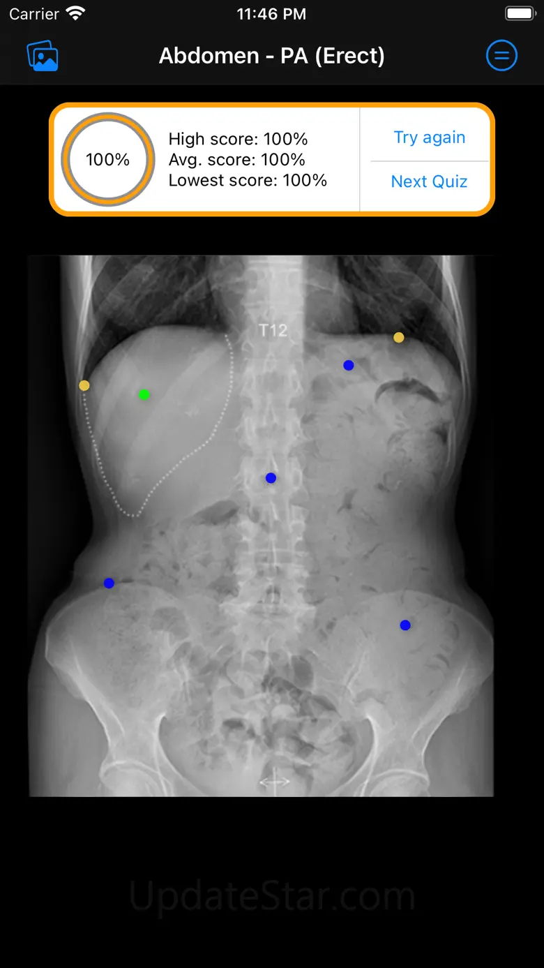 Xray Anatomy 10.1.2