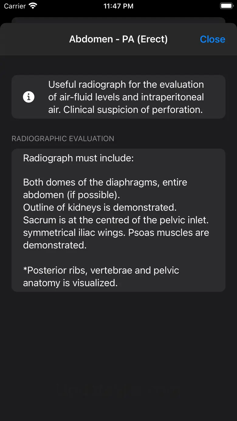 Xray Anatomy 10.1.2
