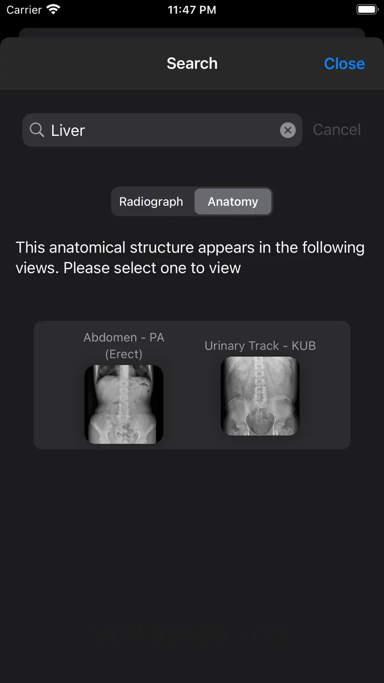 Xray Anatomy 10.1.2