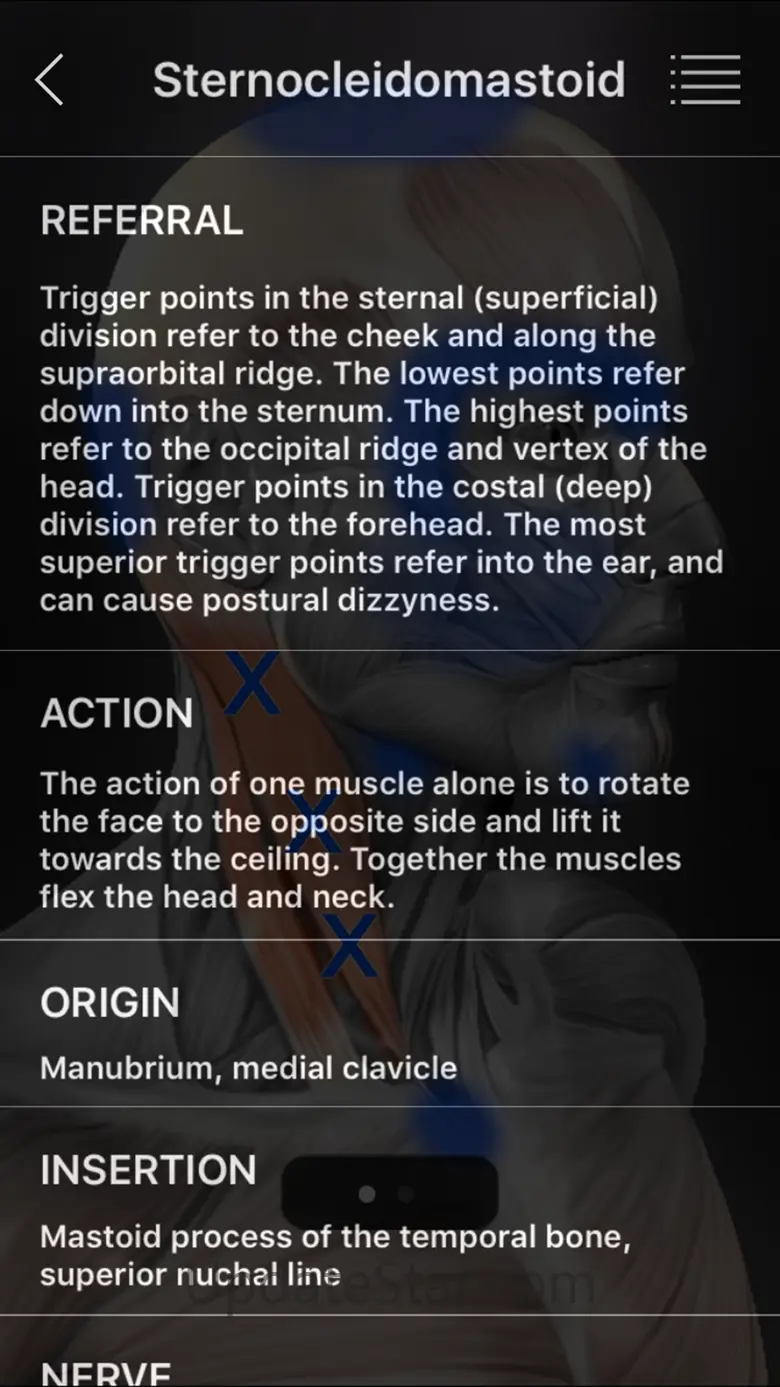 Muscle Trigger Points 6.6