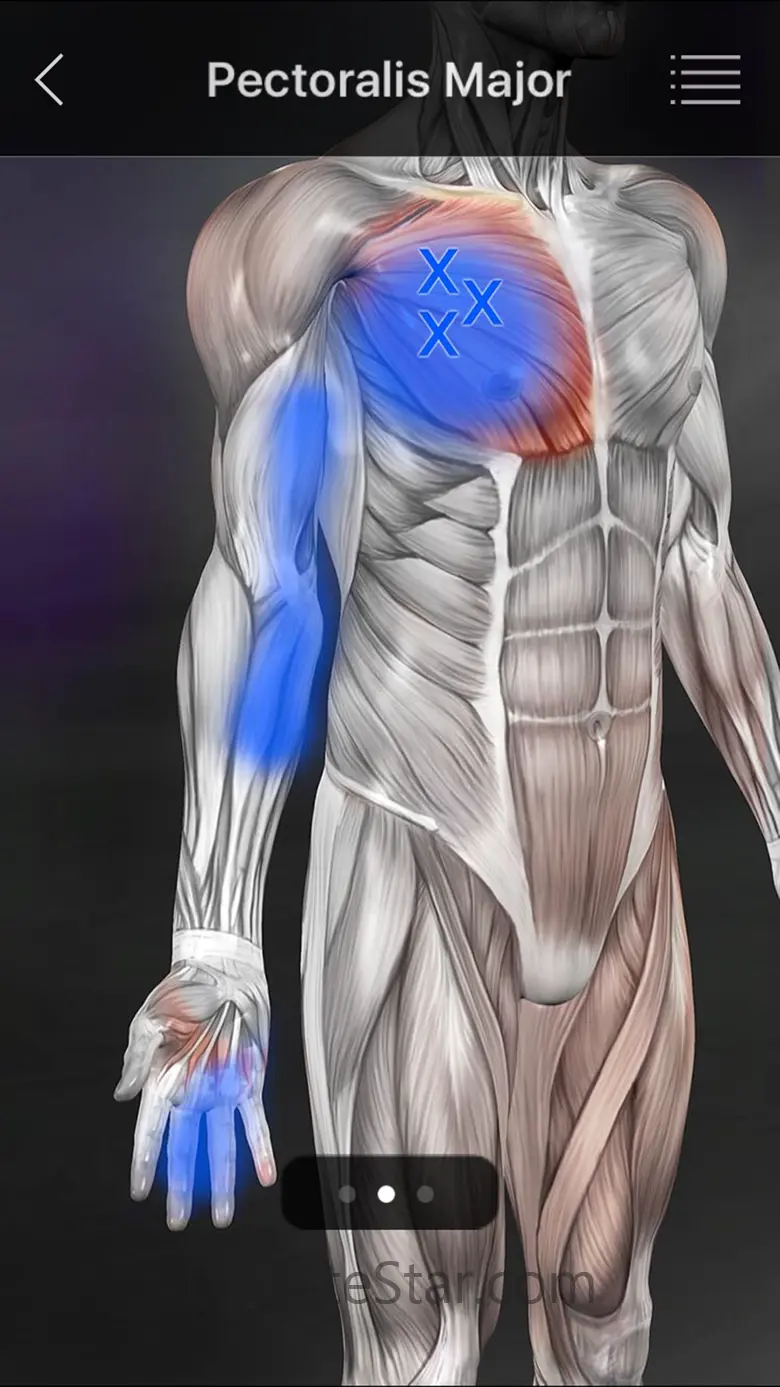 Muscle Trigger Points 6.6