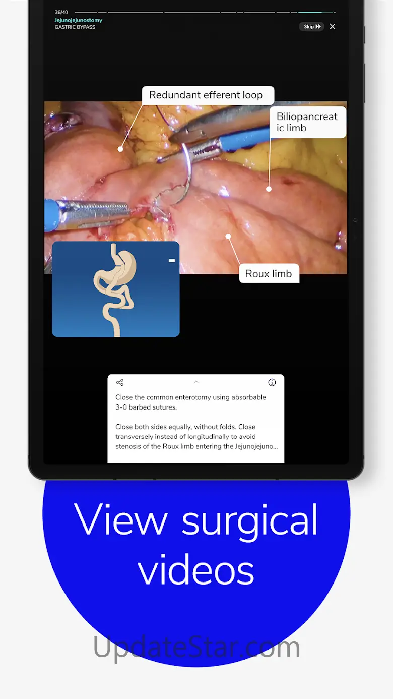 Touch Surgery: Surgical Videos 7.36