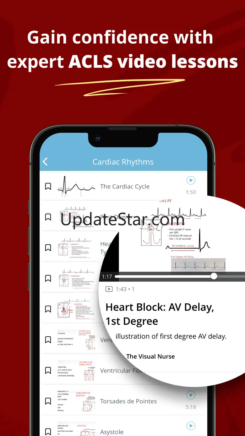 ACLS Mastery Practice 14.1
