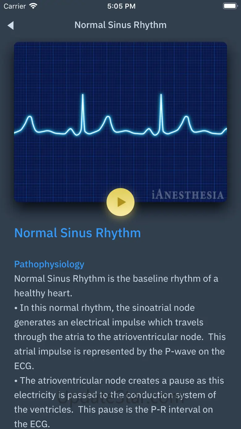 ACLS Rhythms and Quiz 2.0.3