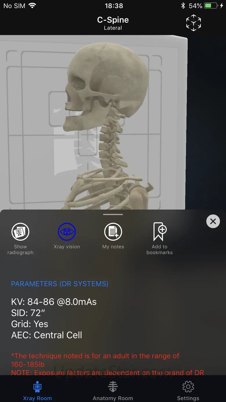 iRad Xrays 11.0.3