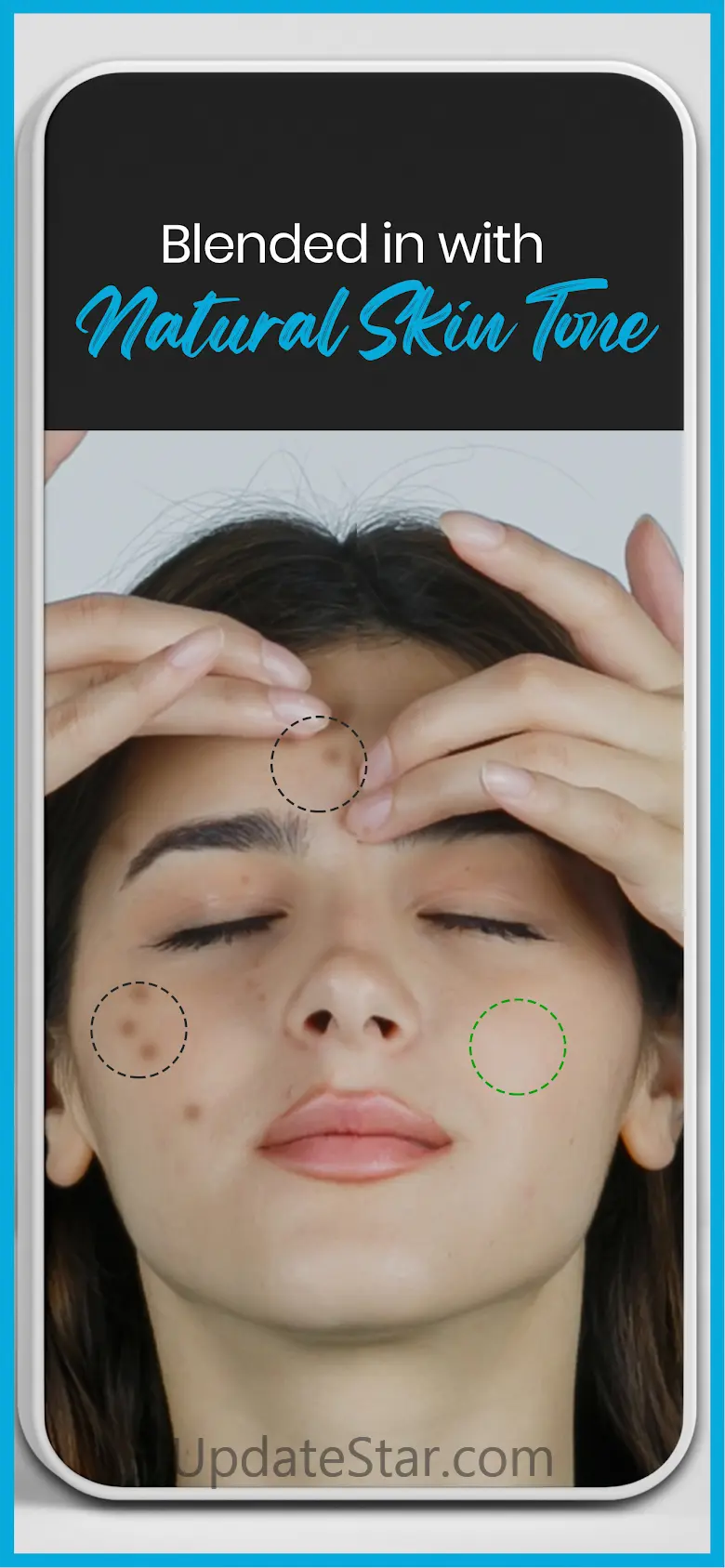 Blemish Editor Pimple Remover 1.7.1