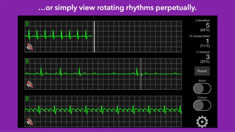arrhythmia 2.1