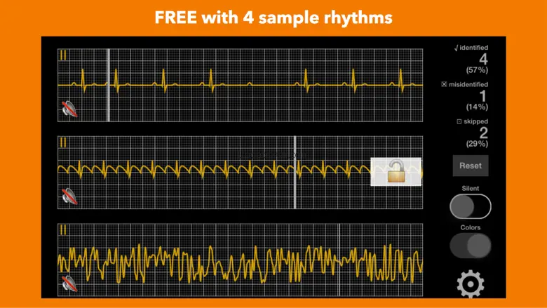 arrhythmia 2.1