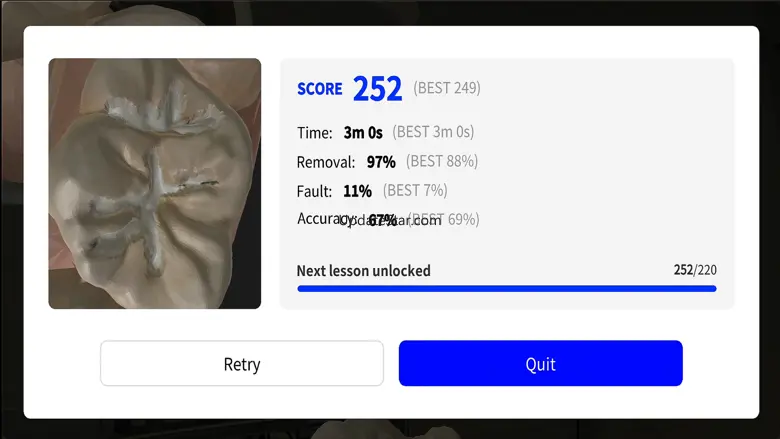 Dental MirrorMaster 2.4.392