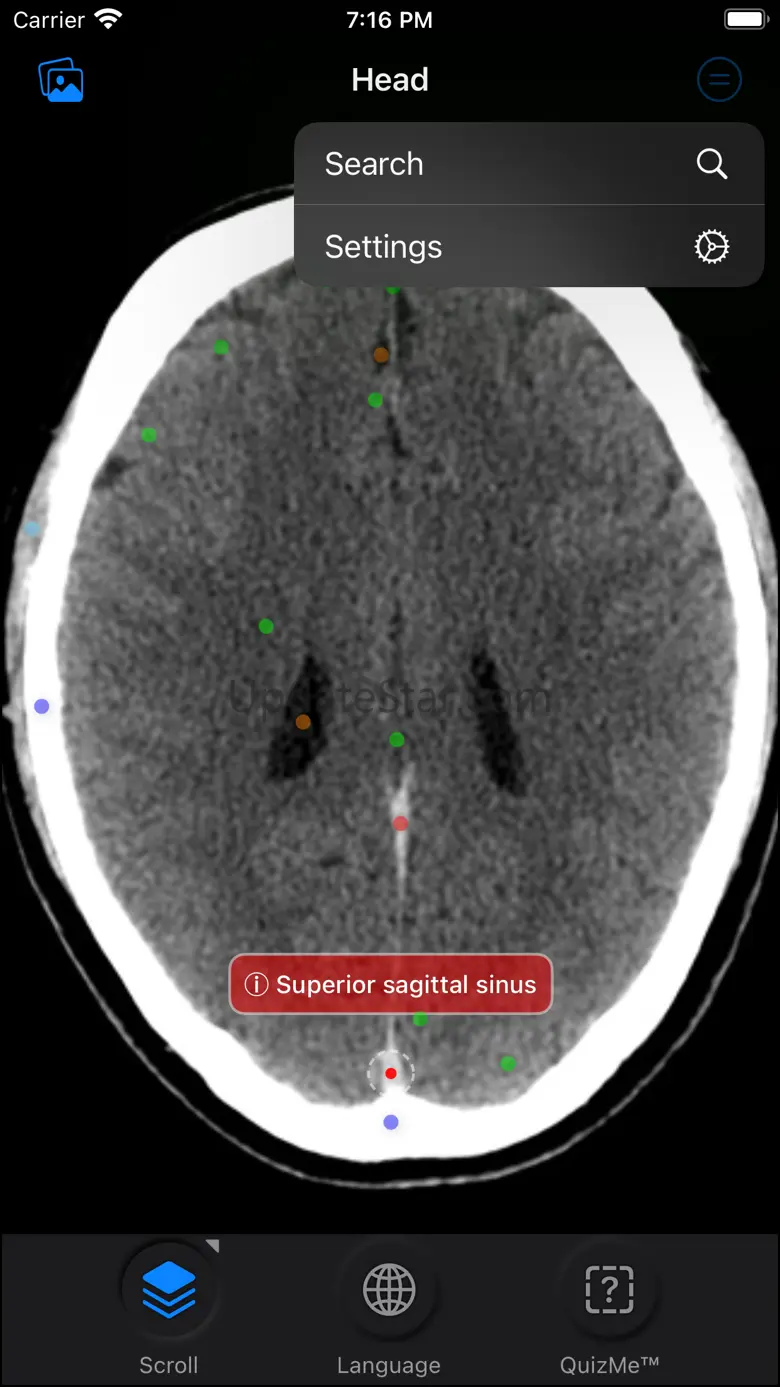 CT Anatomy 10.1