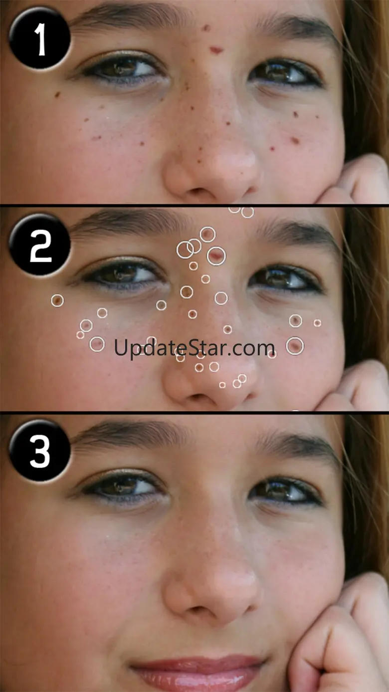 Pimple Eraser LITE 2.1