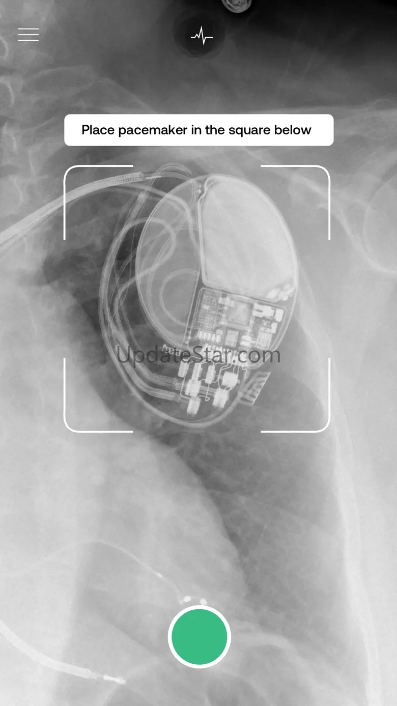 Pacemaker-ID 3.7
