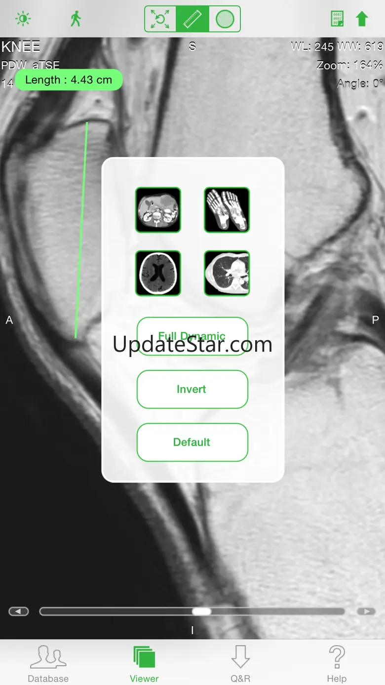 OsiriX HD 5.5.6