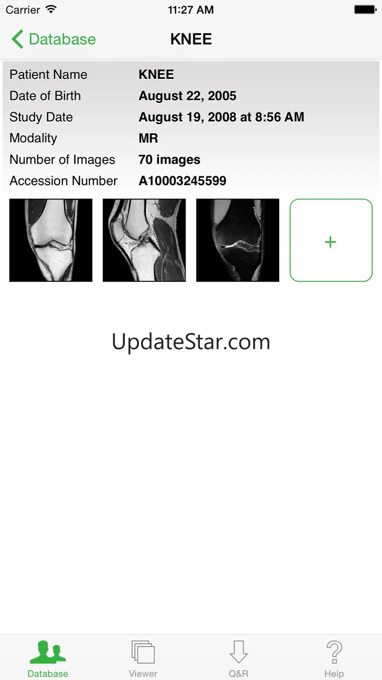 OsiriX HD 5.5.6