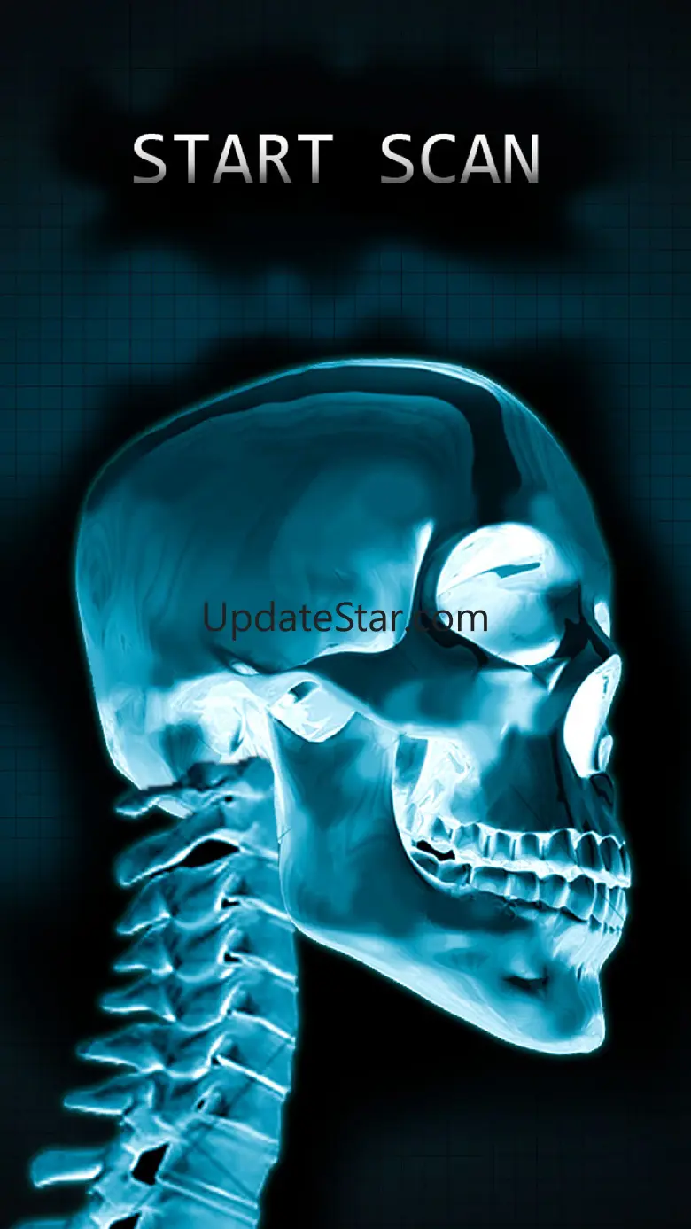 Simulator X-Ray Bone Fake 1.0