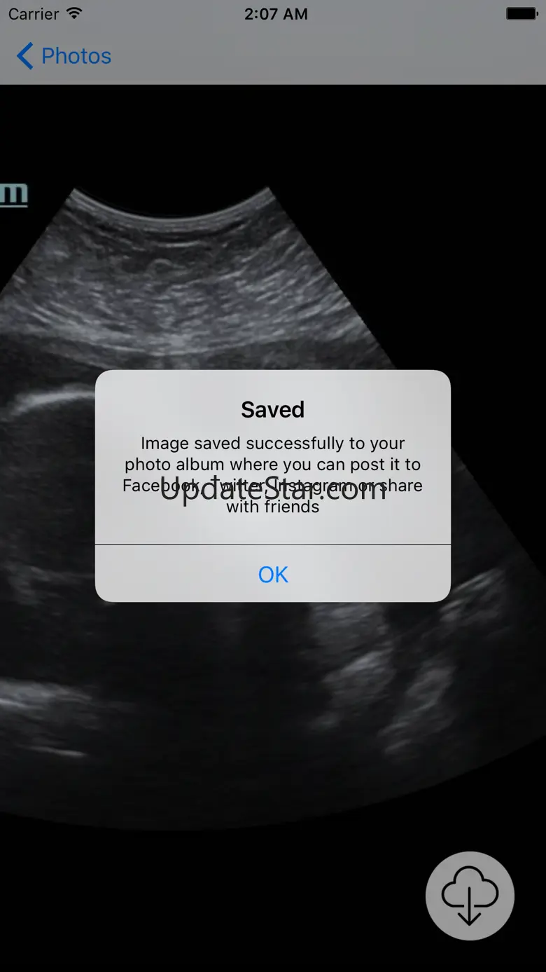 Your Baby Scan - Photo Locker 1.0