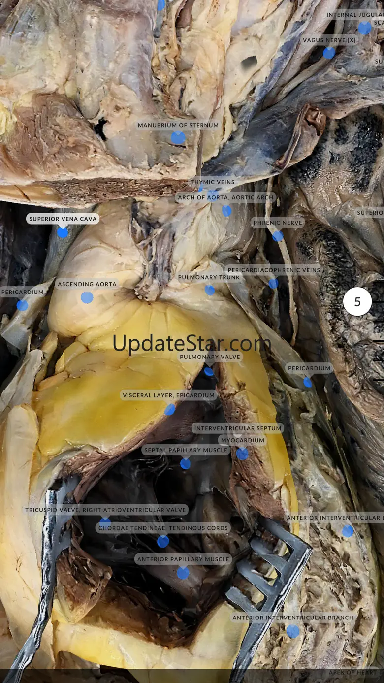Dissection Master XR 1.3