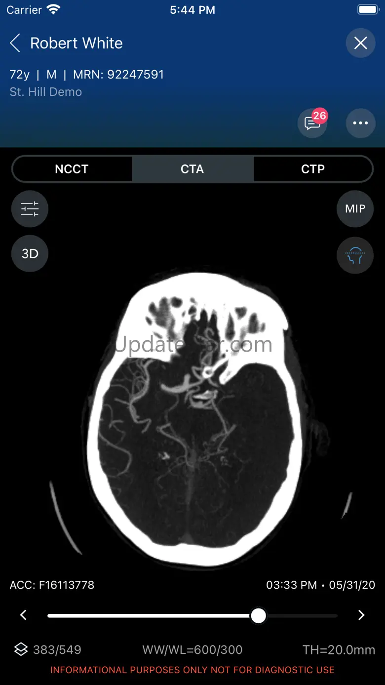 Viz.ai 1.93.8