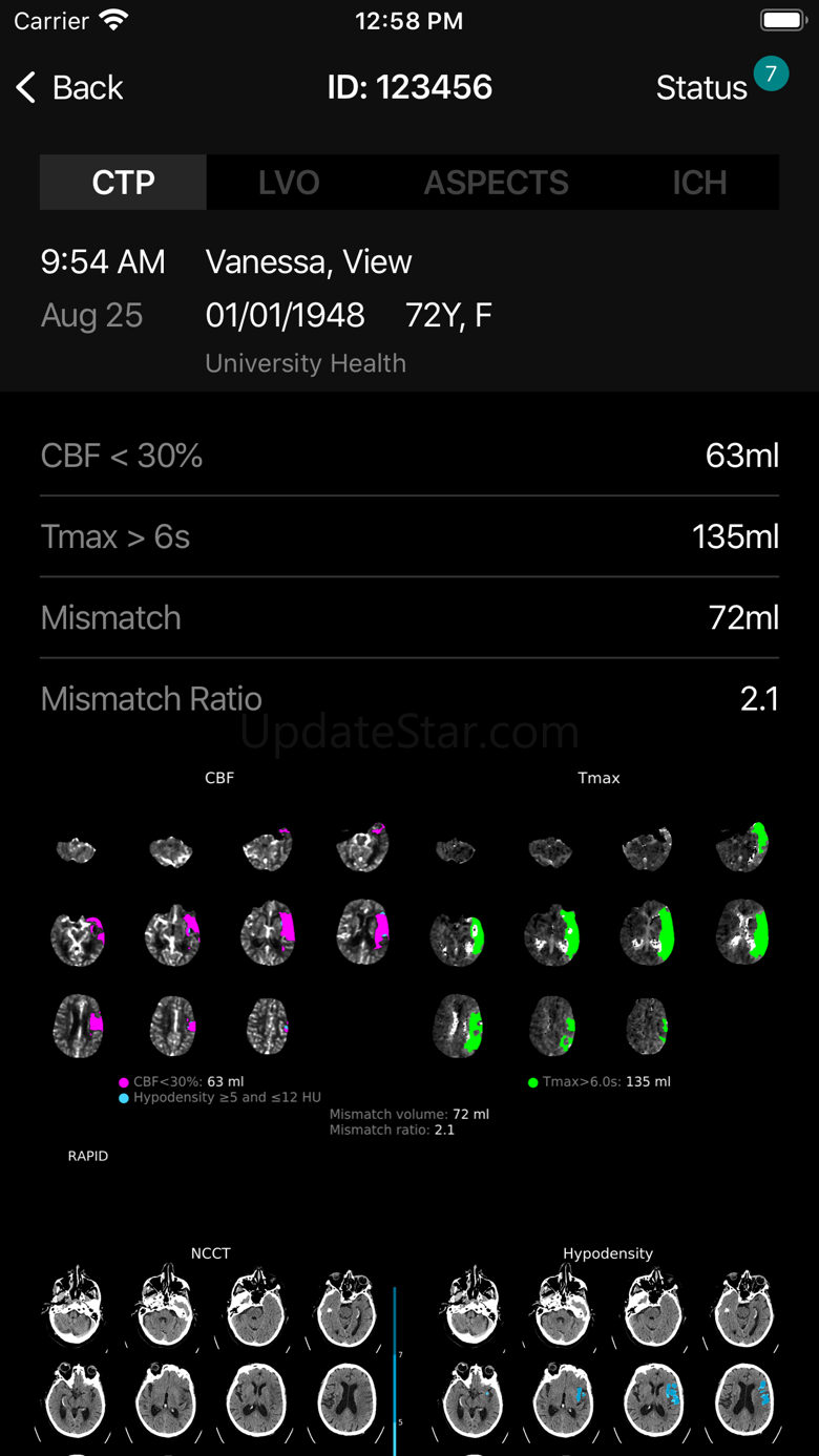 RAPID.AI 3.12.9