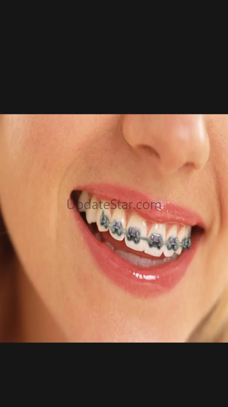 Orthodontic 1.5