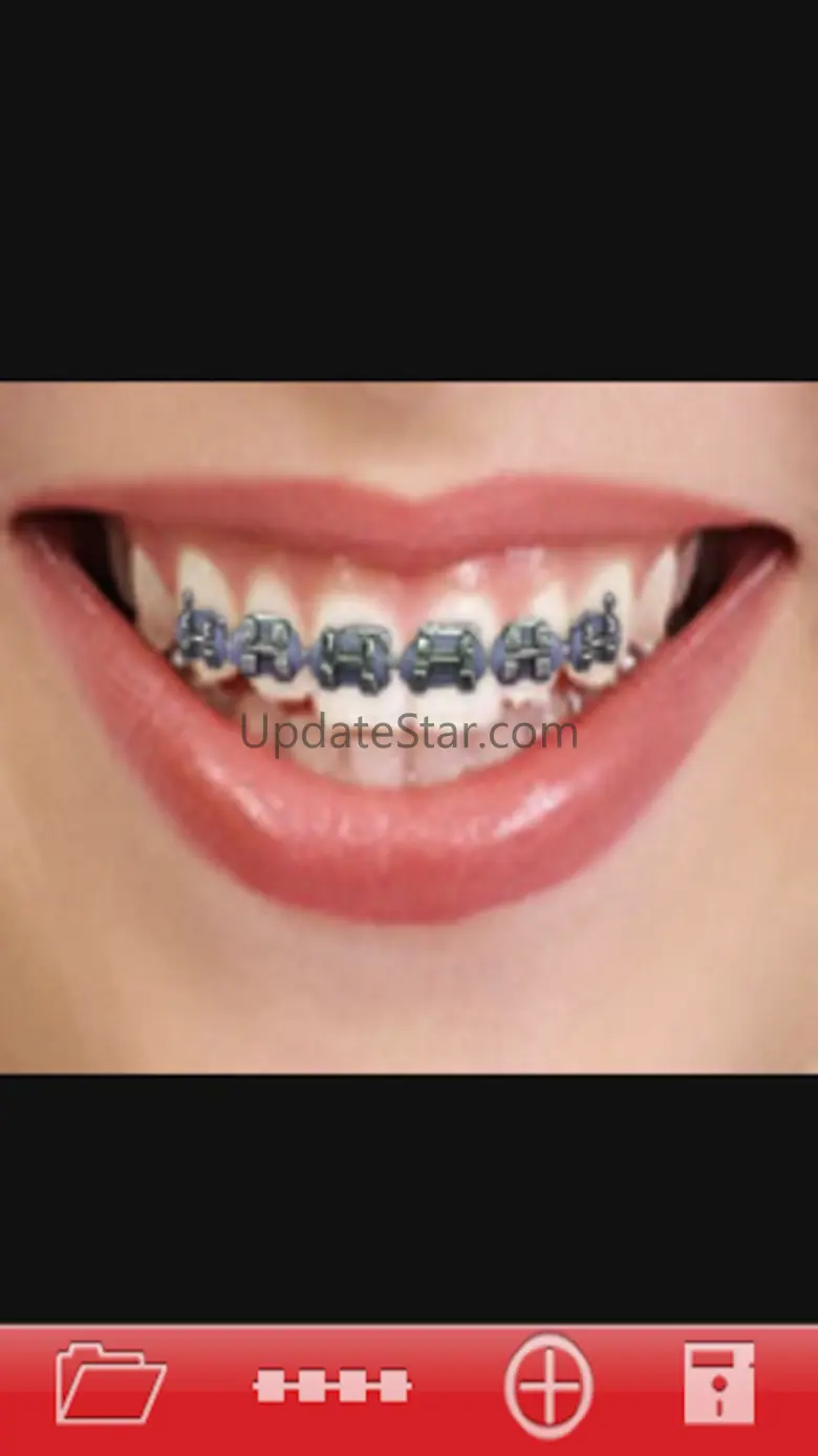 Orthodontic 1.5