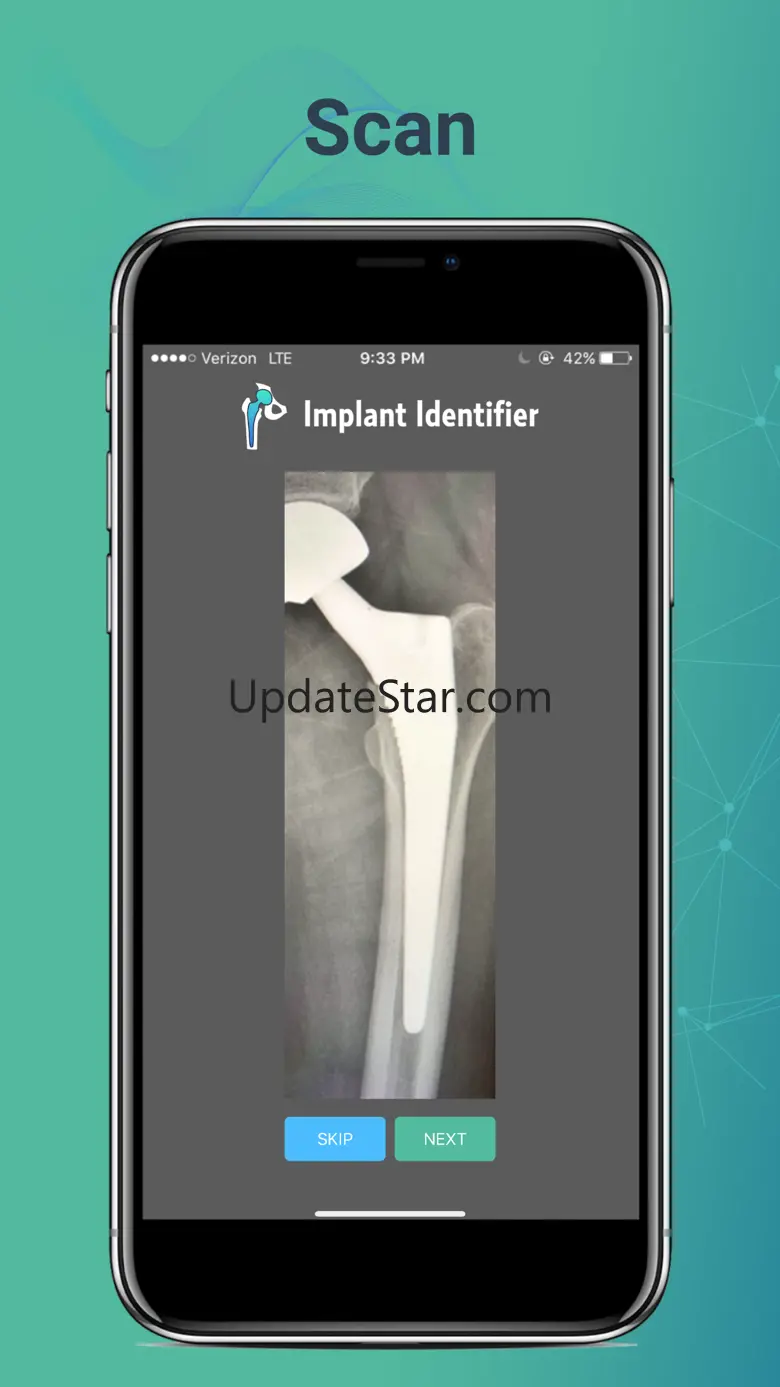 Implant Identifier 2.1.2