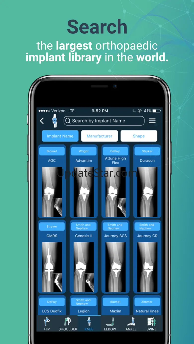 Implant Identifier 2.1.2