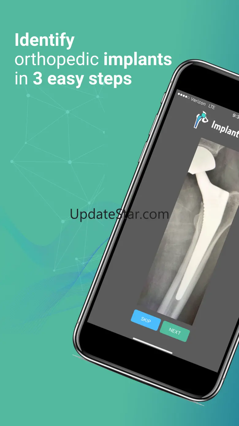 Implant Identifier 2.1.2