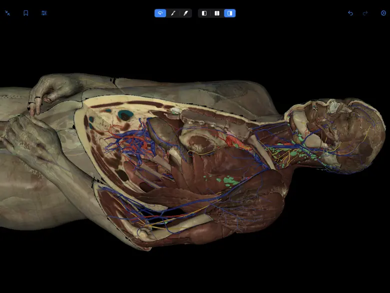 VH Dissector Pro