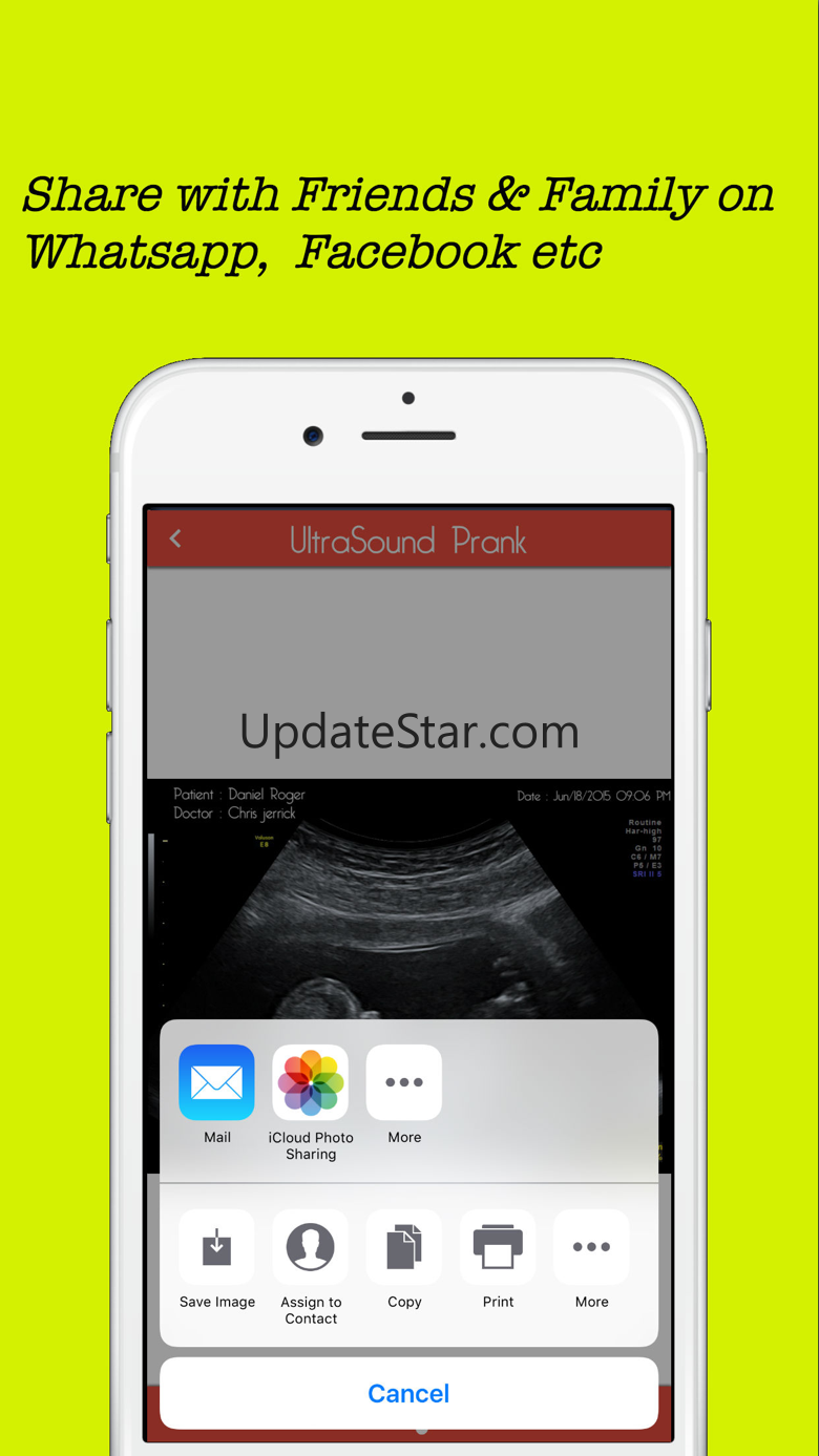 Baby Ultrasound spoof 1.5