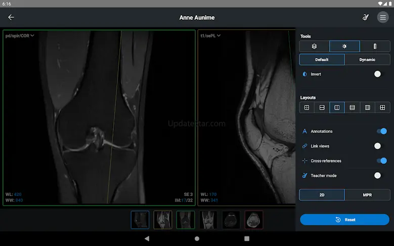 IDV - IMAIOS DICOM Viewer 2.3.2