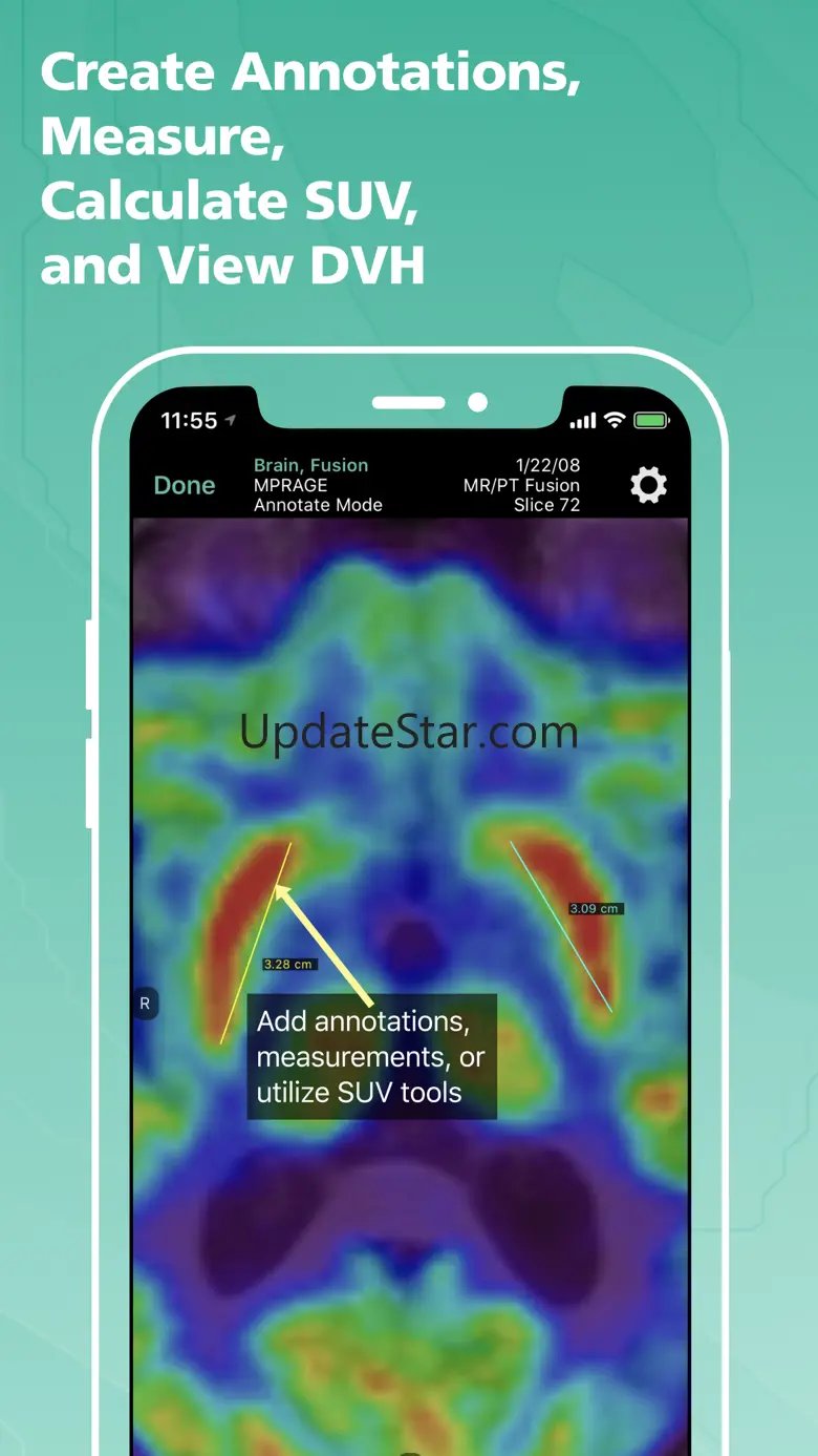 Mobile MIM 4.2.2