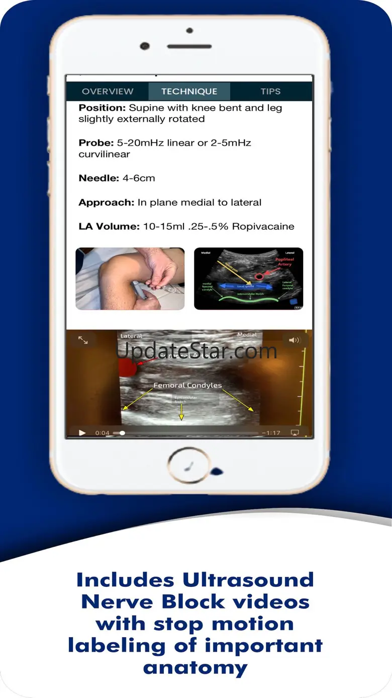 PNBschool Anesthesia Blocks 3.0